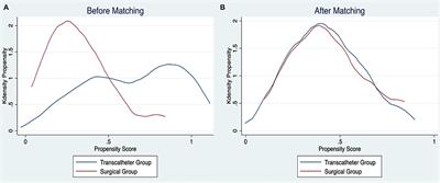 Anterior Minithoracotomy vs. Transcatheter Closure of Patent Ductus Arteriosus in Very Preterm Infants